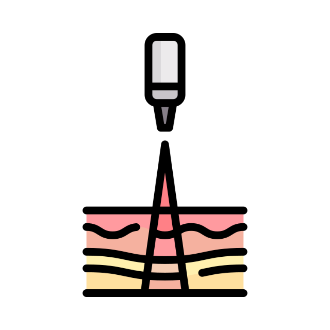 Icono fotorejuvenecimiento IPL