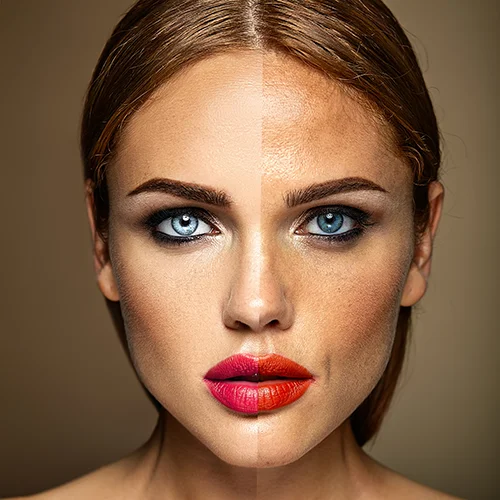 Antes del tratamiento