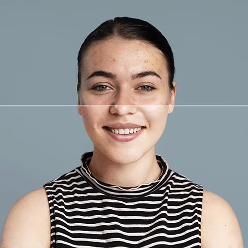 Antes del tratamiento