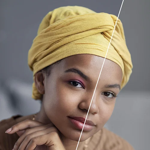 Antes del tratamiento