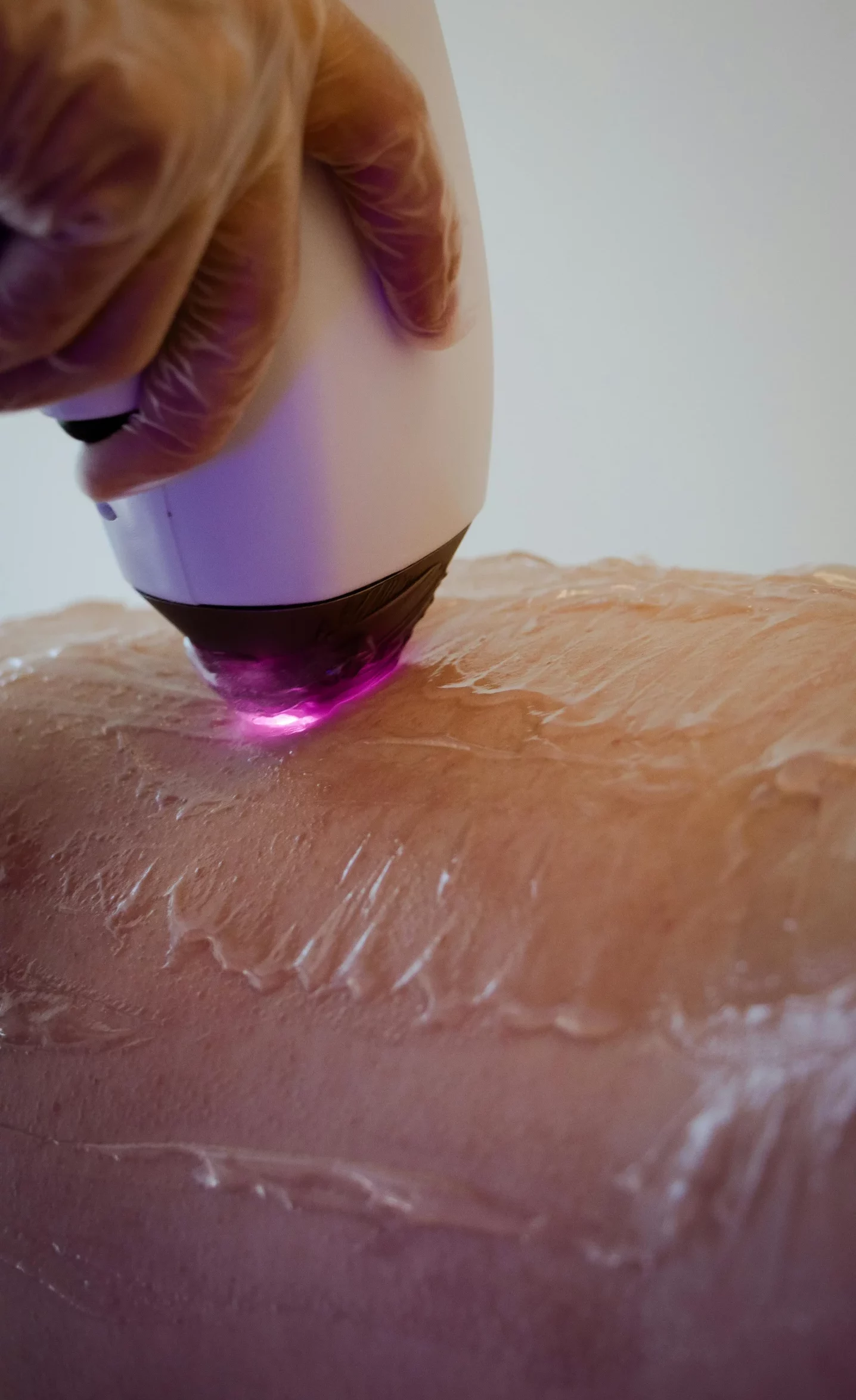 Tratamientos esteticos piel