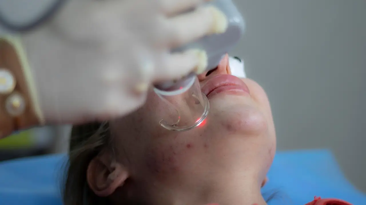 Tratamiento facial con laser